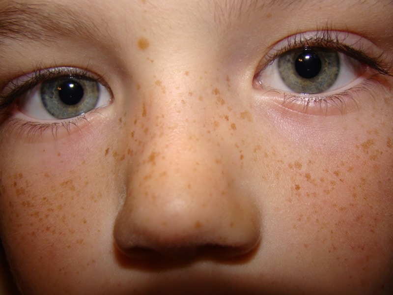 کرم ضد لک قوی- کک و مک صورت- مجله باسلام