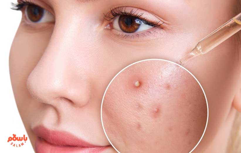 درمان بیماری های پوستی