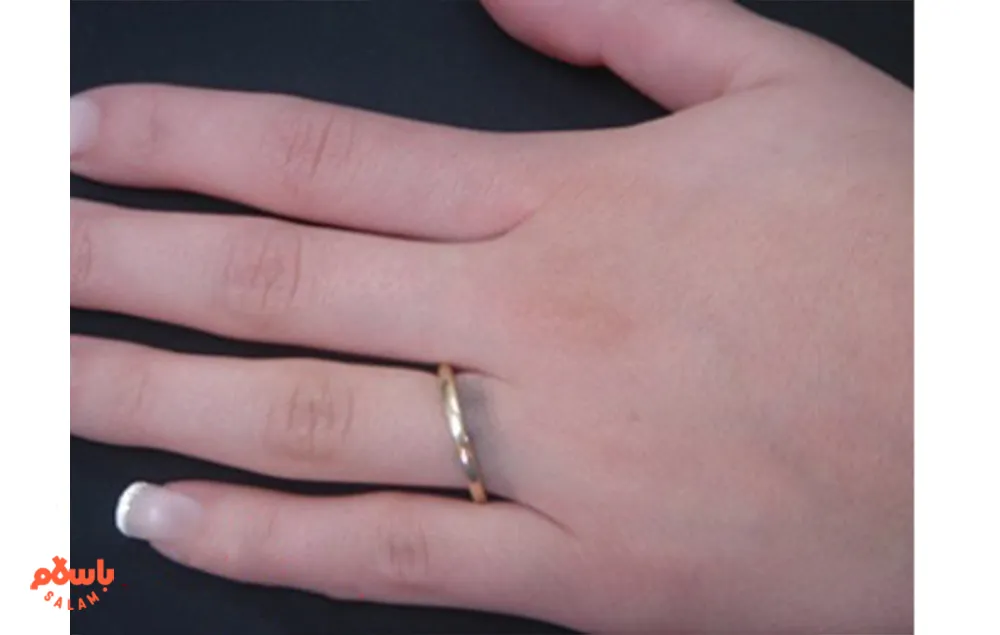 سیاه شدن جای طلا