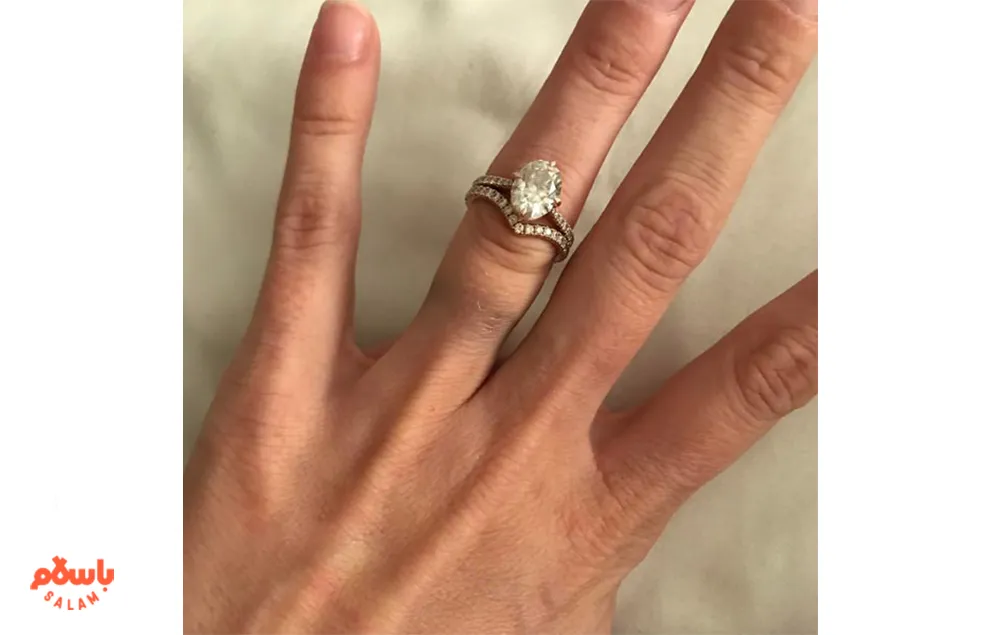 چرا انگشتر نقره دست را سیاه می کند