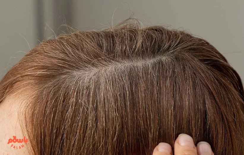 رنگ مو از برند ولا کلستون