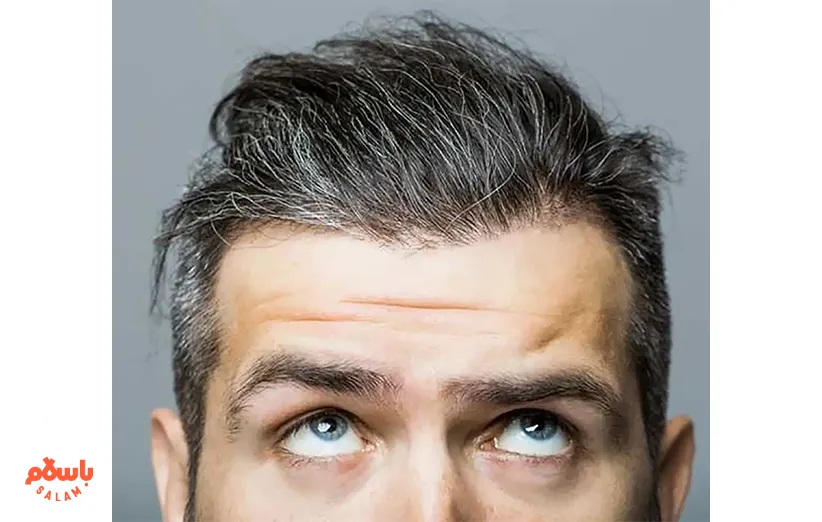 بهترین مارک رنگ مو برای موهای سفید مردانه